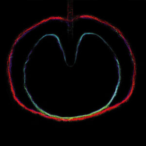 XTC Wasp Star